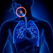 Sleep Apnoea Treatments