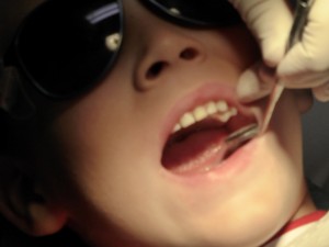 Boy opening wide for dentist