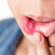 What Diseases Can A Dentist Diagnose?