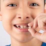 What To Do If Your Child Knocks Out A Tooth!