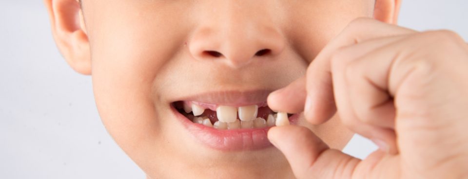 child knocks out tooth