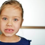 Adult Teeth Coming In Behind Baby Teeth? What Can You Expect?