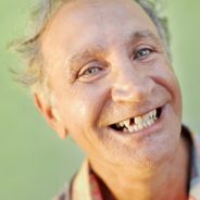 Tooth Replacement Options – No Gaps!