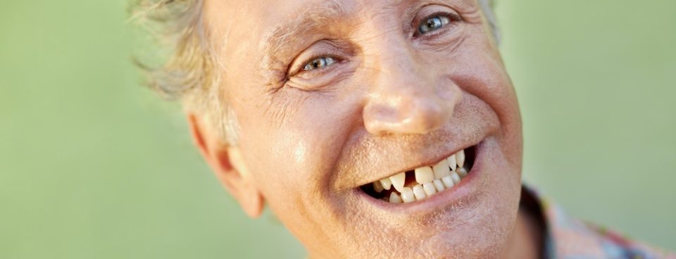 Tooth replacement