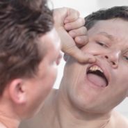 Loose Teeth In Adults! What To Do When You’ve Got The Wiggles!