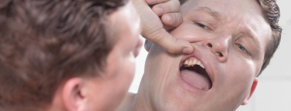 loose teeth in adults