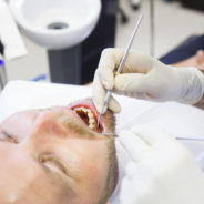 Back Teeth Problems – Should You Get a Root Canal or an Extraction?