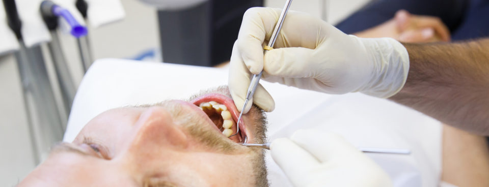 root canal
