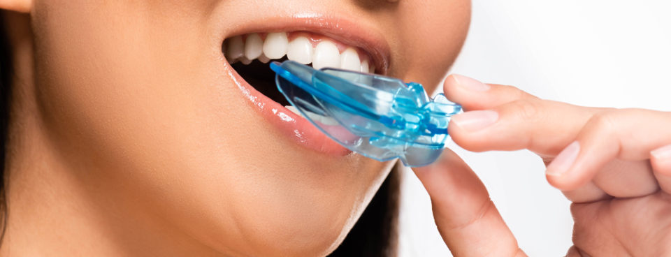 Sleep apnoea? A mouth guard might be just the solution you need.